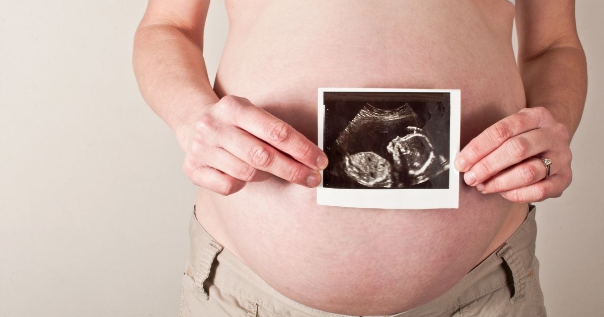 Ultrasound Scans During Pregnancy: Are They Safe?
